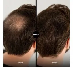 Shake Over Fibre Capillari Istantanee | Effetto Capelli Più Folti Naturale Shake Over Fibre Capillari Istantanee con Zinco – Effetto Capelli Più Folti Naturale